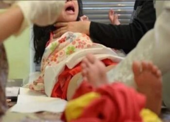 في اليوم العالمي لـ “رفض ختان الإناث” .. تعرف علي اجراءات مصر لمحاصرة عمليات ختان الإناث وتجريمها