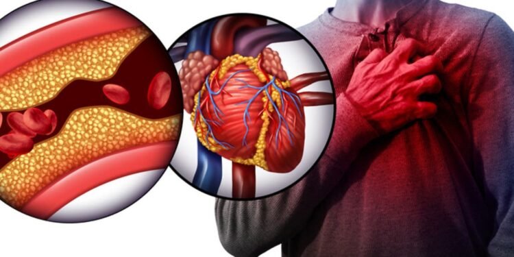 “الكوليسترول” القاتل الصامت الذي يهدد صحة المواطنين