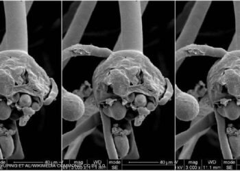أبرزها تورم جانب الوجه .. أعراض الاصابة بالفطر الأسود