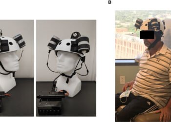 اختراع خوذة لعلاج سرطان المخ
