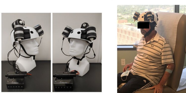 اختراع خوذة لعلاج سرطان المخ