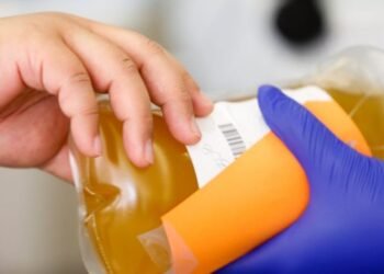 تفاصيل خطة الحكومة لتحقيق الاكتفاء الذاتى من مشتقات البلازما