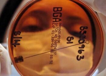 يحارب أمراض الجهاز الهضمي.. اكتشاف فيروس جديد نافع للبشر