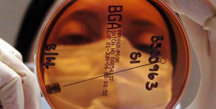 يحارب أمراض الجهاز الهضمي.. اكتشاف فيروس جديد نافع للبشر