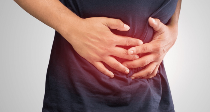 جراح عالمي ينصح بعمل منظار القولون لمن تخطي الـ 45 عام