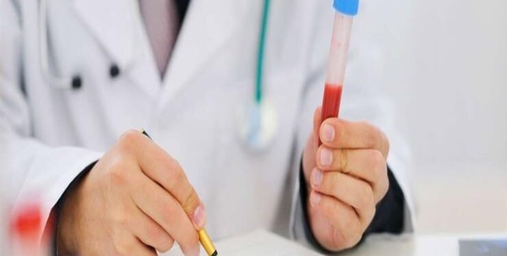 قانون العمل الجديد يلزم العامل بتحليل مخدرات متي طلب منه صاحب العمل.. شاهد التفاصيل