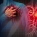 استشاري قلب يوضح أسباب الموت المفاجئ وطرق الوقاية